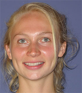 Clear beautiful skin.