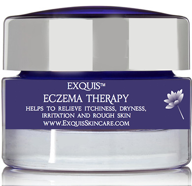 Eczema Therapy